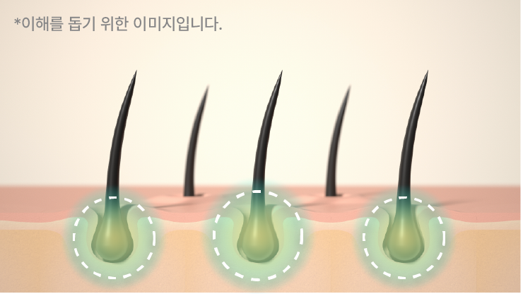 비엘모세트구성두피토