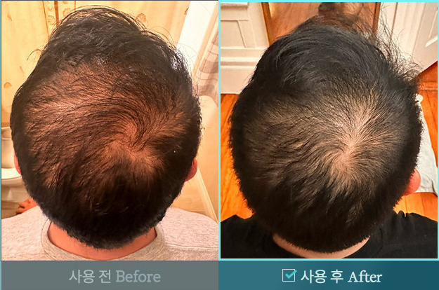 비엘모세트구성두피토