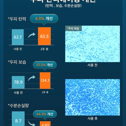 모제림 엘릭서 탈모샴푸세트 300ml 약산성 실리콘프리 플로럴향